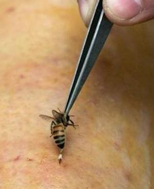 apitherapy bee venom therapy